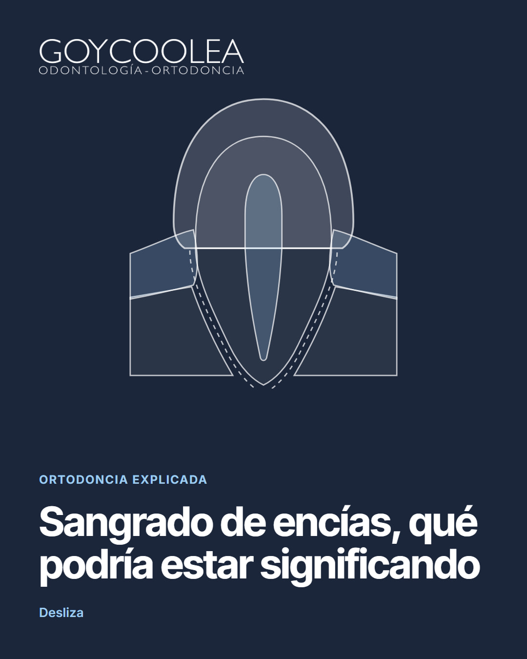 Carrusel educativo sobre las causas del sangrado de encías