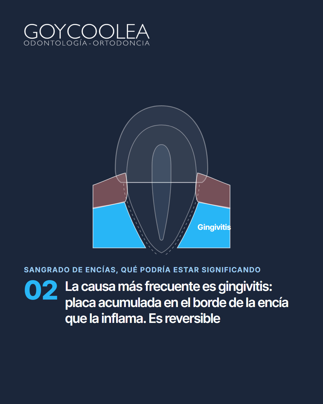 Carrusel educativo sobre las causas del sangrado de encías