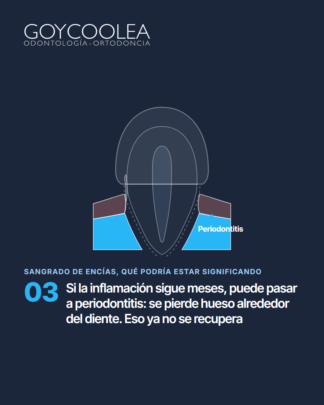 Carrusel educativo sobre las causas del sangrado de encías