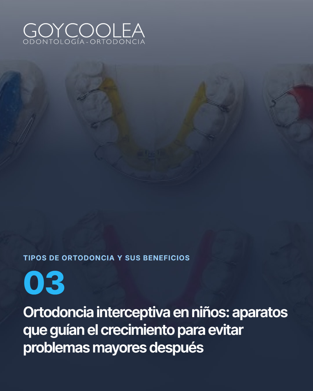 Carrusel educativo sobre los tipos de ortodoncia disponibles