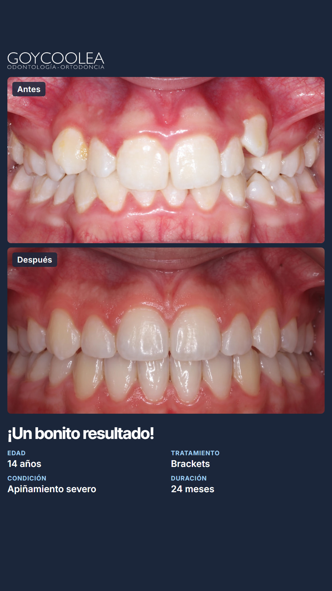 Historia resumen del caso clínico, antes y después, para la destacada Casos