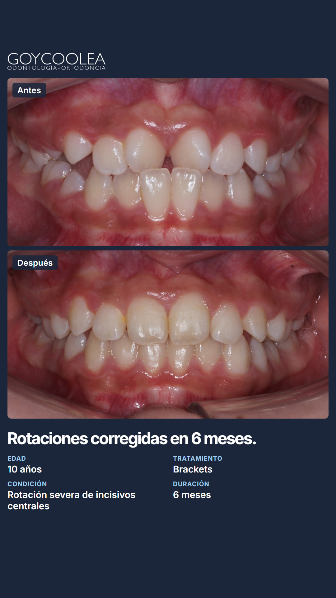 Historia resumen del caso clínico, antes y después, para la destacada Casos