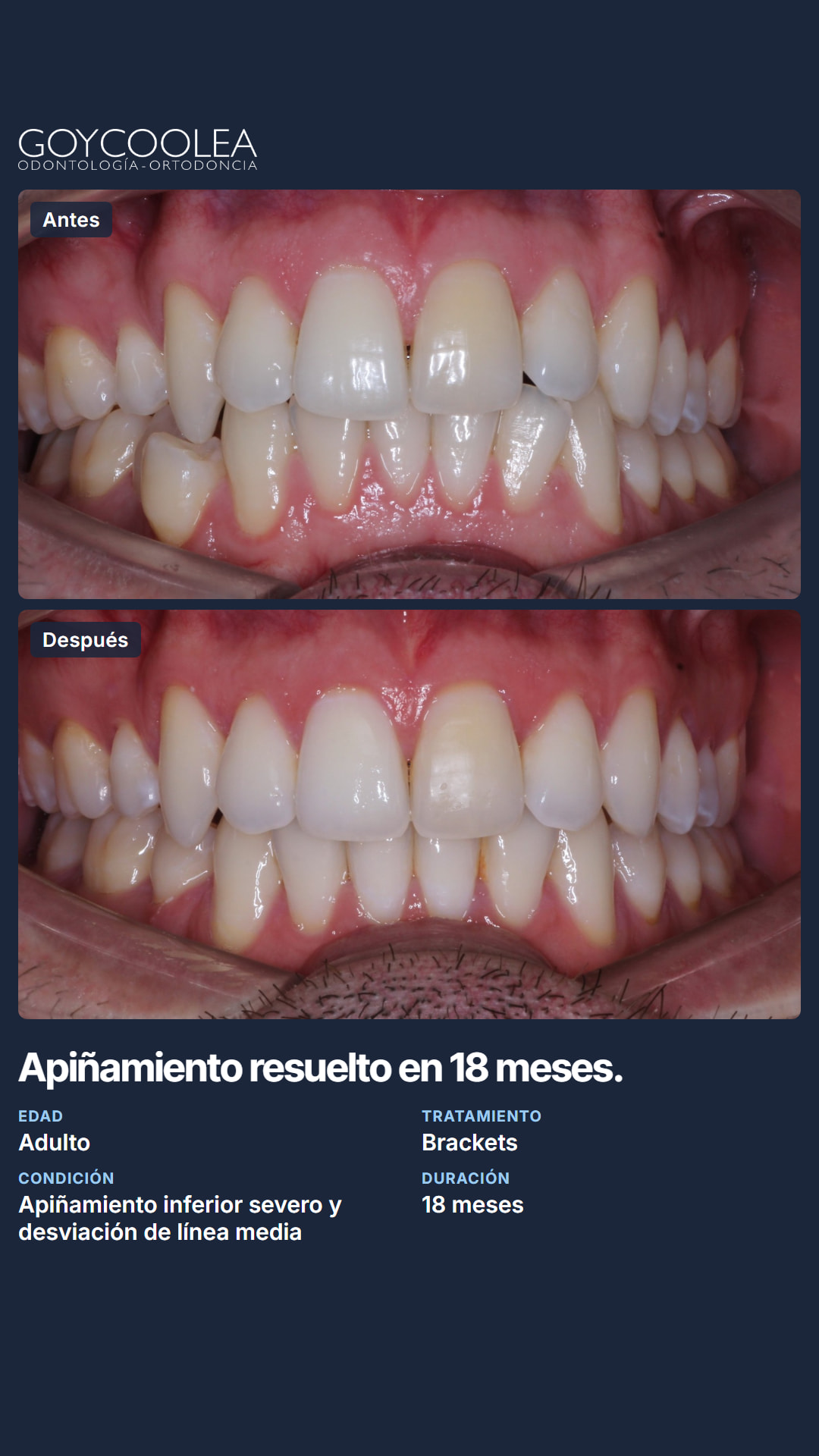 Historia resumen del caso clínico, antes y después, para la destacada Casos