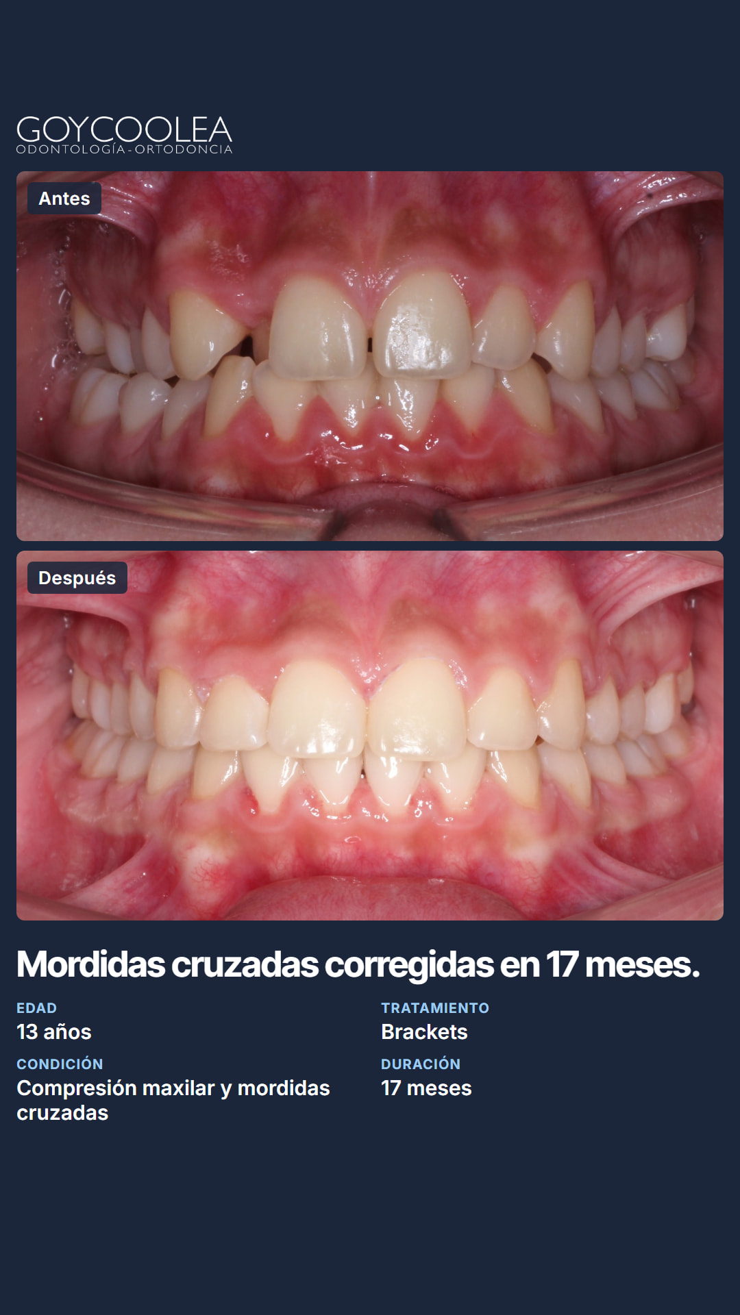 Historia resumen del caso clínico, antes y después, para la destacada Casos