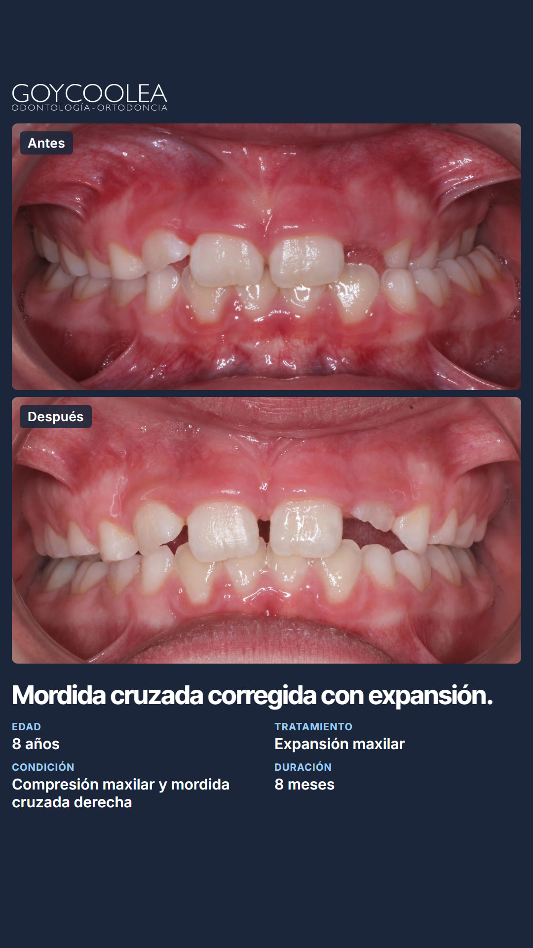 Historia resumen del caso clínico, antes y después, para la destacada Casos