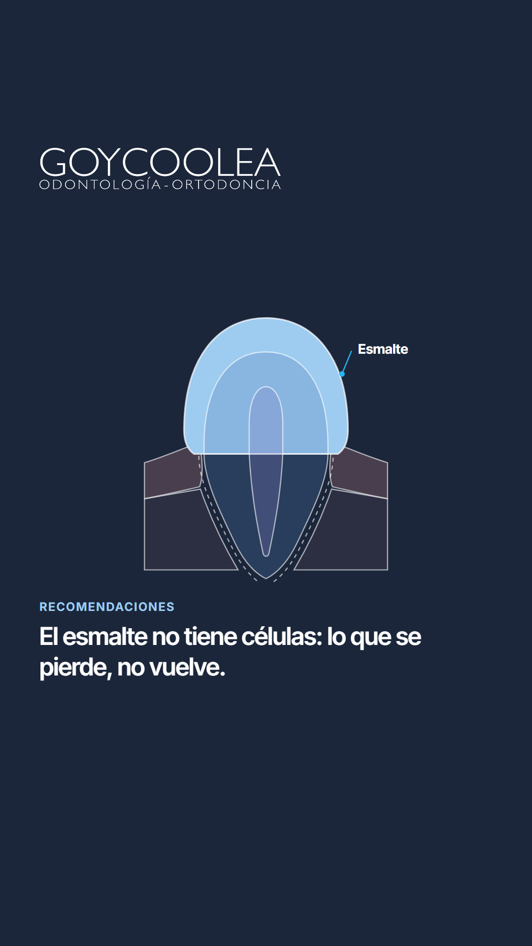 Historia con el esquema del esmalte y una frase breve del carrusel, para la destacada Recomendaciones