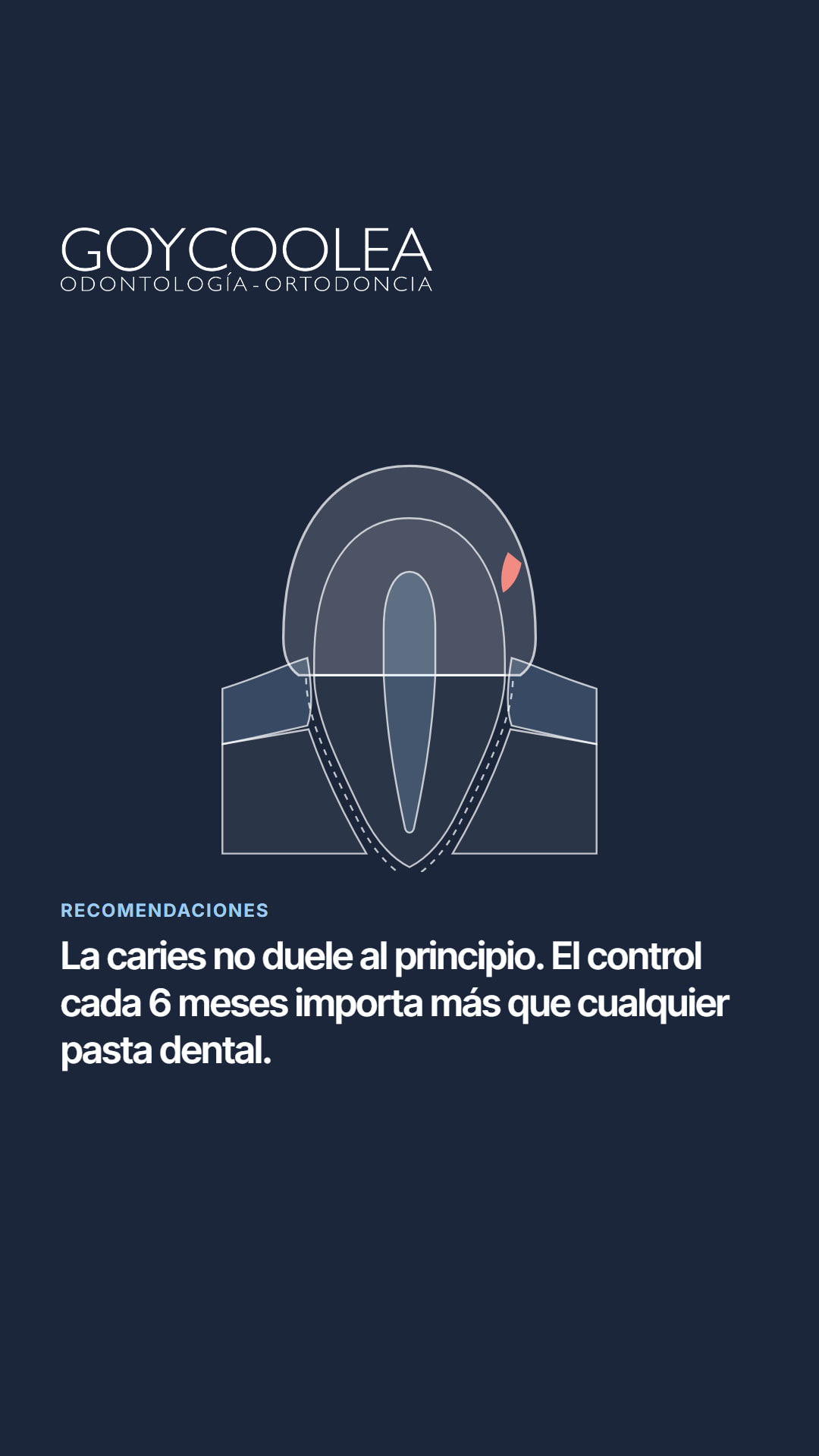 Historia con el esquema de una caries y una frase breve del carrusel, para la destacada Recomendaciones