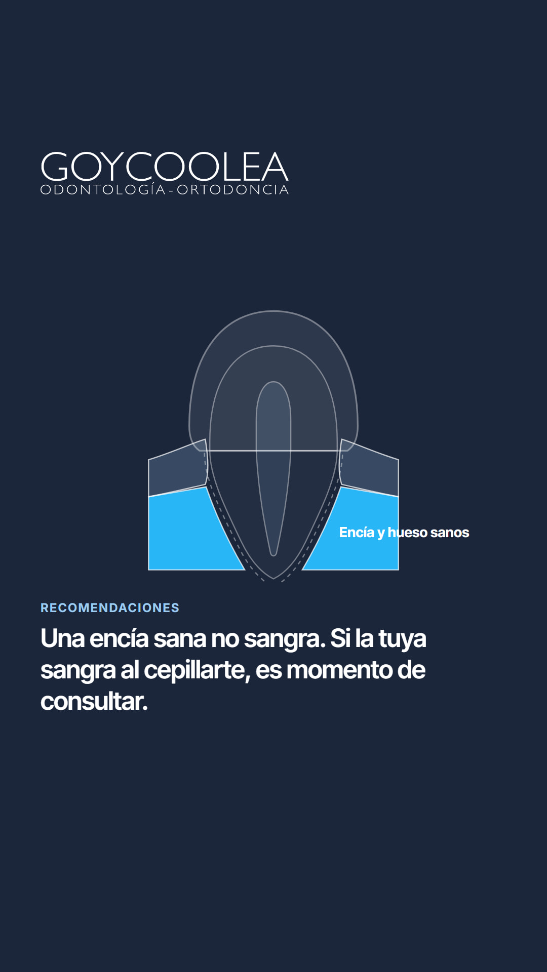 Historia con el esquema de una encía sana y una frase breve del carrusel, para la destacada Recomendaciones