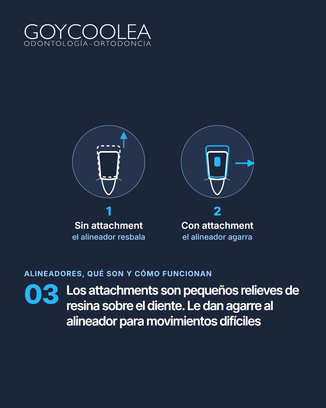 Carrusel educativo sobre cómo funcionan los alineadores transparentes