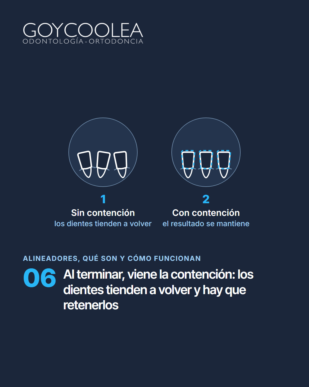 Carrusel educativo sobre cómo funcionan los alineadores transparentes