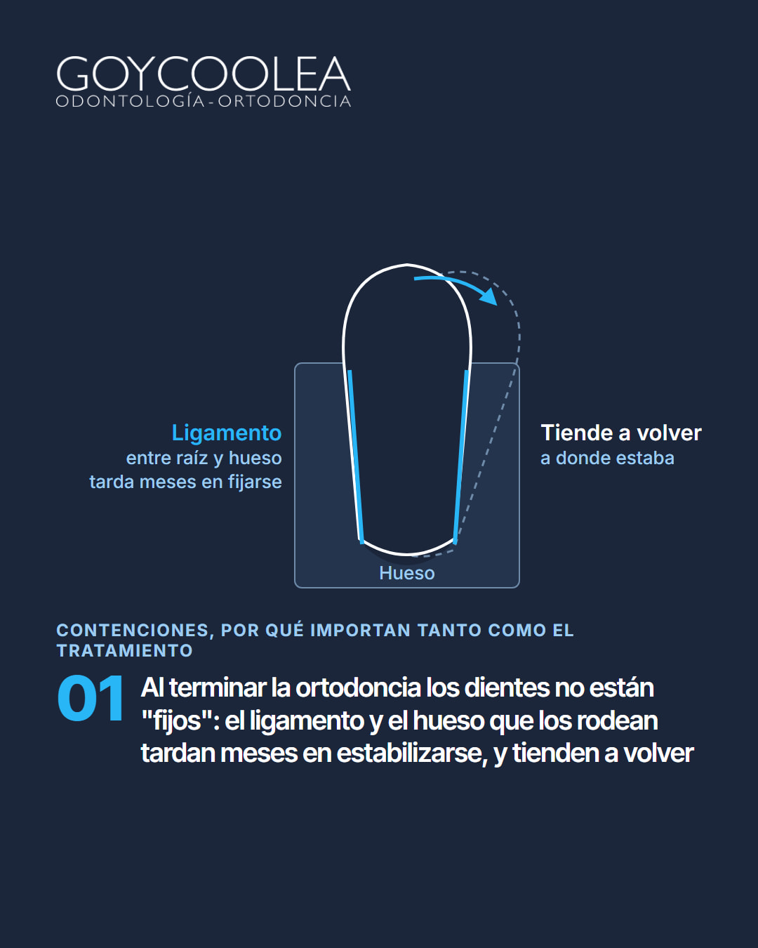 Carrusel educativo sobre las contenciones de ortodoncia, fijas y removibles, y su cuidado