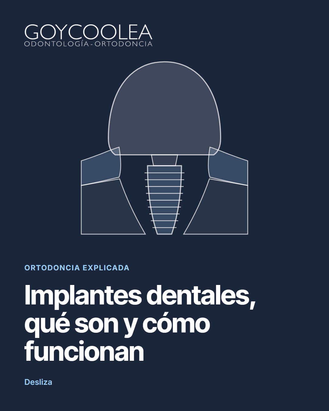 Carrusel educativo sobre los implantes dentales, con esquema del implante en el hueso