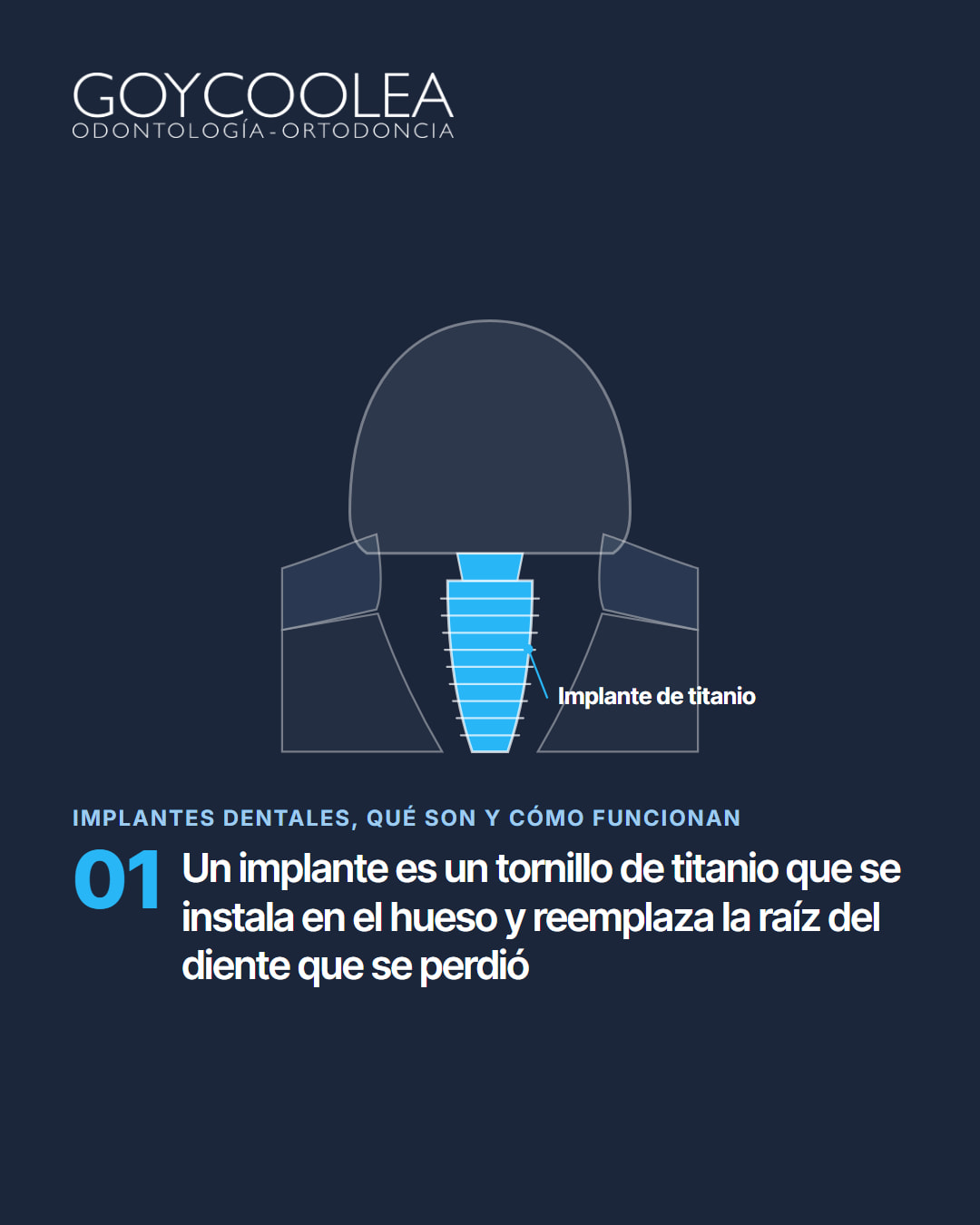 Carrusel educativo sobre los implantes dentales, con esquema del implante en el hueso