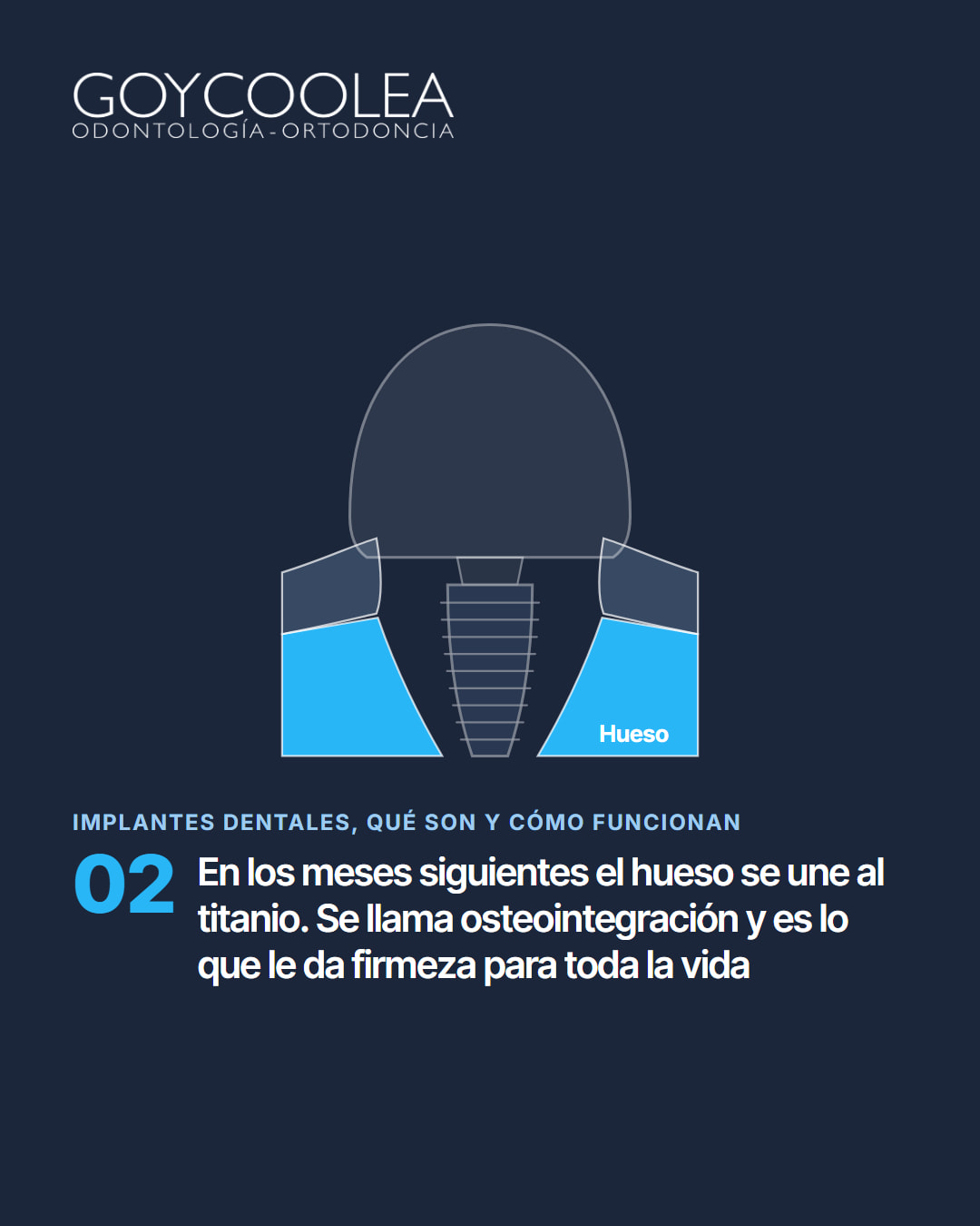 Carrusel educativo sobre los implantes dentales, con esquema del implante en el hueso