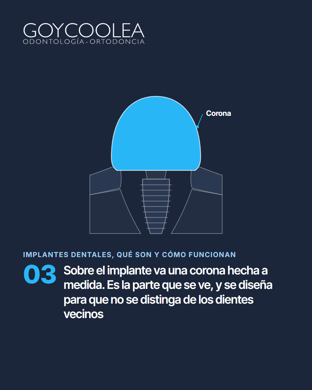 Carrusel educativo sobre los implantes dentales, con esquema del implante en el hueso