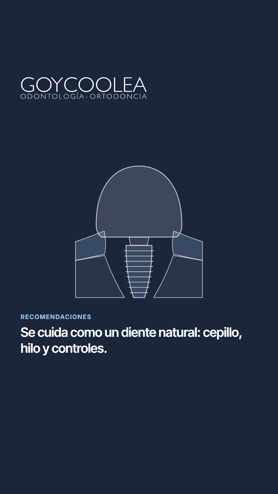 Historia con el esquema del implante y una frase breve del carrusel, para la destacada Recomendaciones